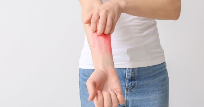 Allergens are substances that can trigger an allergic reaction in the human body. An allergic reaction may show up on the skin, as respiratory symptoms, or as digestive problems.
