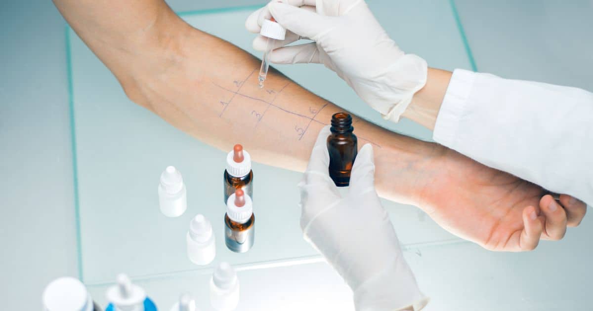 Expect the doctor to run tests — not just for pet allergy, but for other types of allergies too. This may involve a blood test or skin prick tests, where a small amount of allergen is applied to the skin and the reaction is monitored.