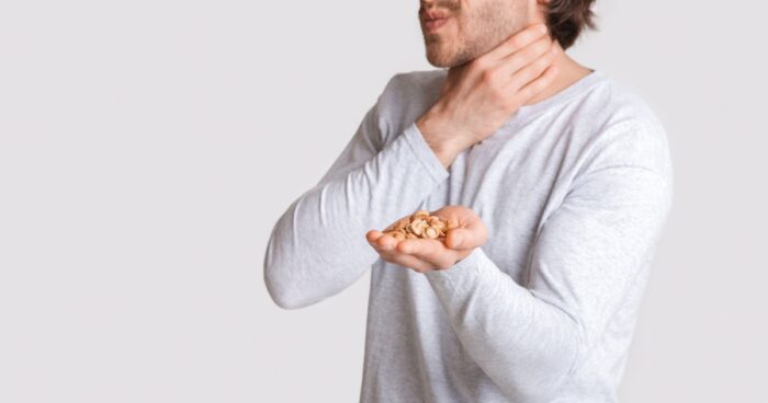 Nut allergy is an immune reaction to proteins in nuts, which are made up of amino acids. These amino acids are remarkably resistant to external factors, so their structure remains unchanged even after heat processing or during digestion.