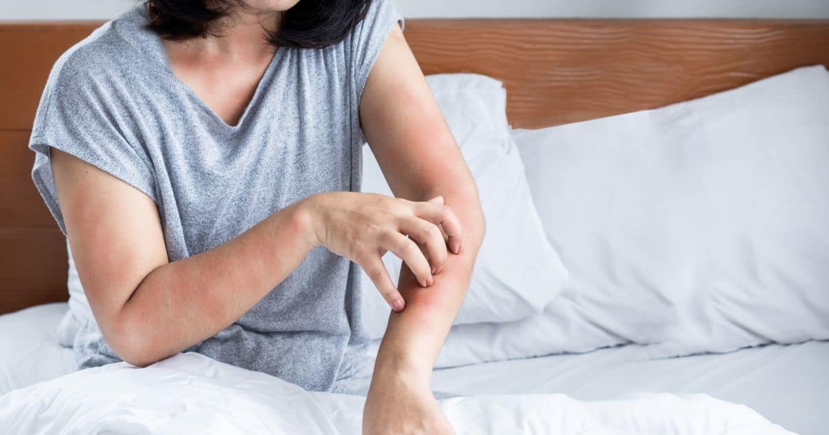 The most common symptoms of a laundry detergent allergy include itchy skin, rash, redness, flaking, and sometimes even swelling.