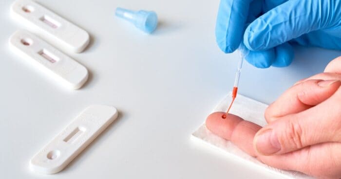 Latex allergy — Testing for latex allergy is preceded by a thorough medical history. Subsequent tests can take two forms.