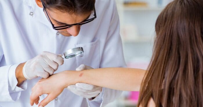 When treating a cosmetic allergy, it's important to follow all medical advice. Corticosteroid creams are used in the acute phase, but regular moisturising and allergen avoidance form the basis of treatment.
