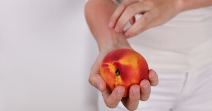 The most common food allergens include: eggs, milk, nuts, fish, shellfish, soy, wheat, legumes, fruit, and vegetables.