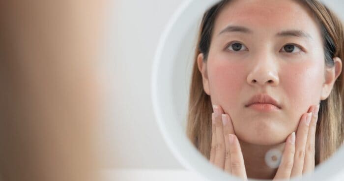 Cosmetic allergy symptoms can vary from person to person in type and severity. The most common signs include redness and itching, rash, swelling, and dry, flaking skin.